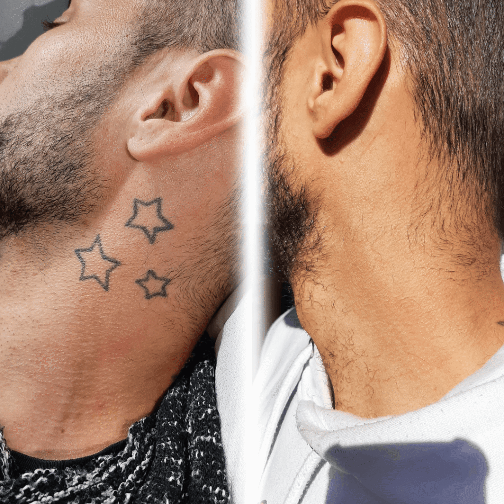 2.ESTRELLAS CUELLO (1)